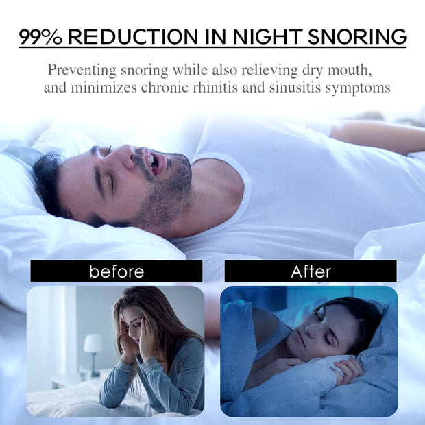 Anti-Snoring Patch Nose Breathing Correction Improve Sleeping Promoting Better Breath Portable Night Sleep Mouth Orthosis Tape